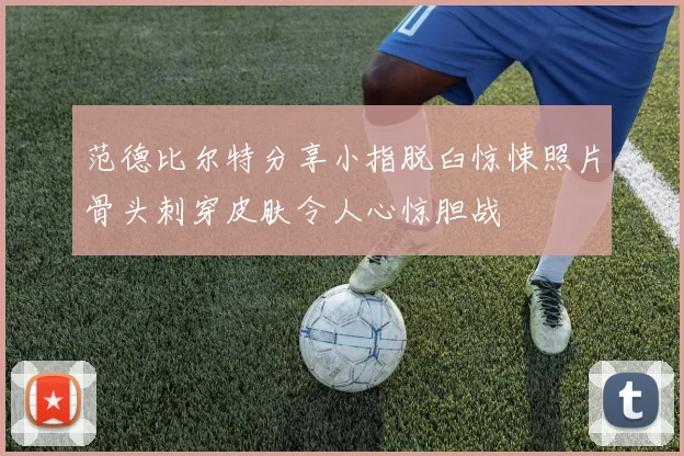 范德比尔特分享小指脱臼惊悚照片骨头刺穿皮肤令人心惊胆战